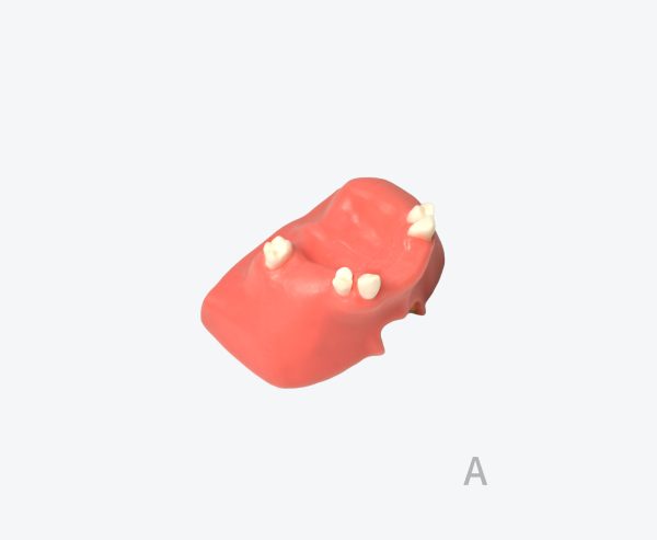 产品图片 6A Maxillary sinus implant training model
