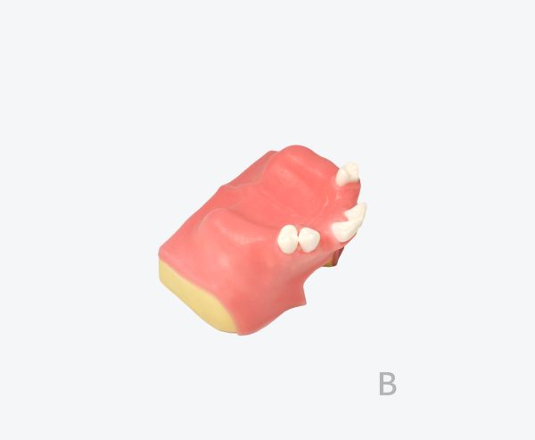 产品图片 6B Maxillary sinus implant training model