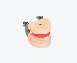 Maxillary sinus dental implant models Maxillary sinus dental implant models