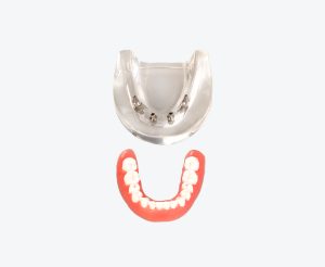 dental implant display models