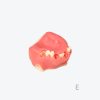Maxillary sinus implant model