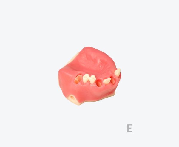 Maxillary sinus implant model