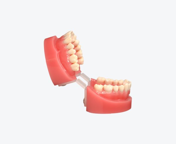 Orthodontics models