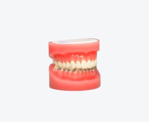 Orthodontics models
