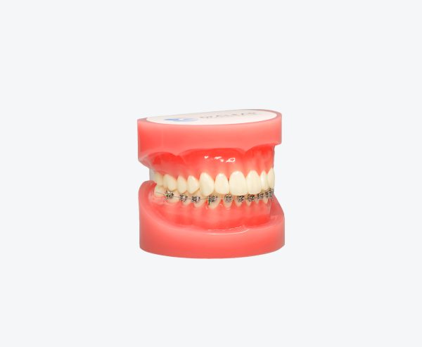 Orthodontics models