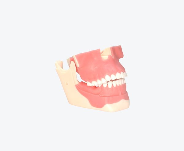 Orthodontics models
