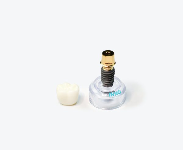 Dental implant model