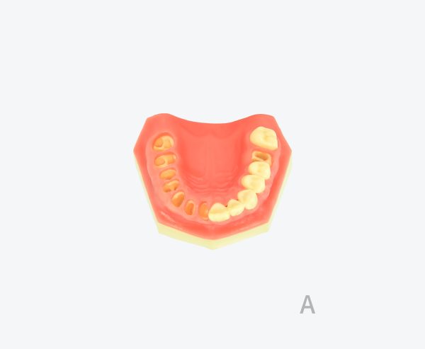产品图片 13A- Upper jaw training model