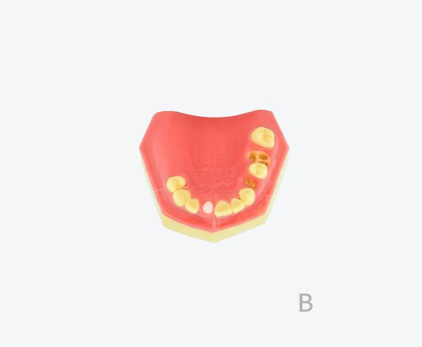 产品图片 13B- Upper jaw training model