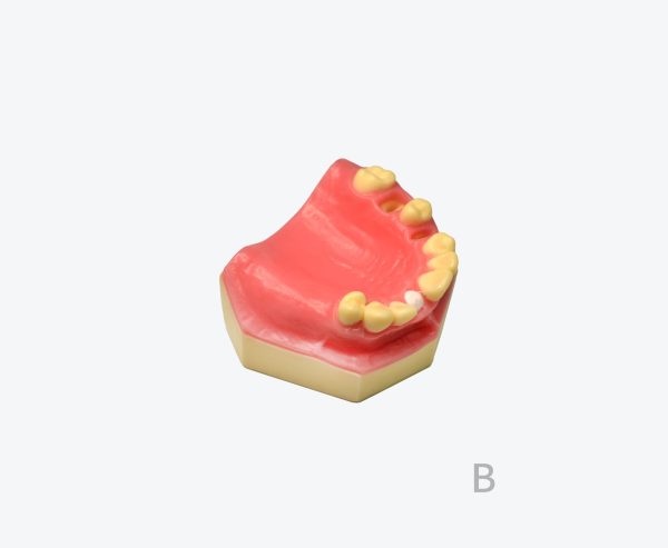 产品图片 13B Upper jaw training model