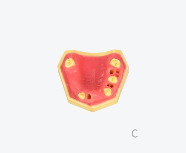 产品图片 13C- Upper jaw training model