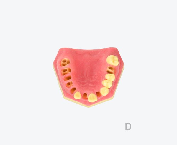 产品图片 13D- Upper jaw training model