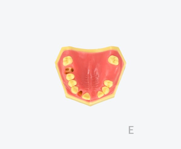 产品图片 13E- Upper jaw training model