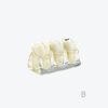 dental caries model