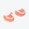 periodontitis model