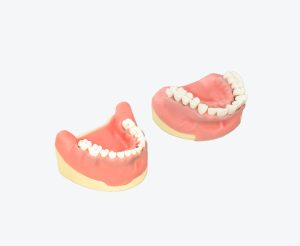 periodontitis model
