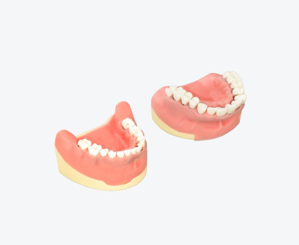 periodontitis model