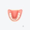 periodontitis model