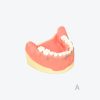 periodontitis model
