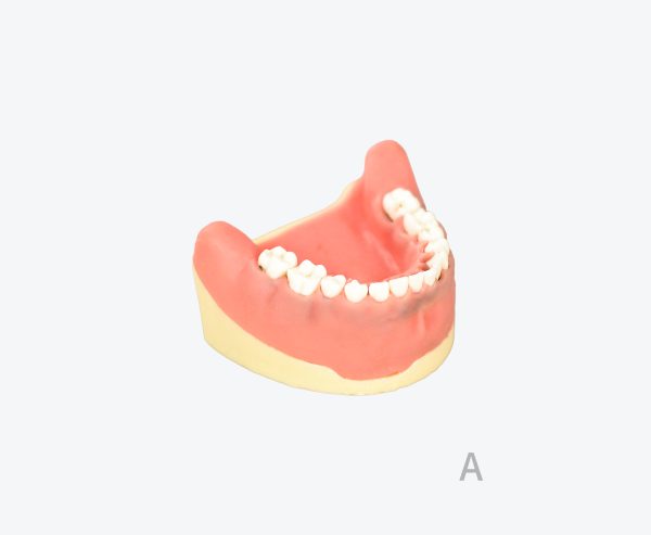 periodontitis model