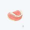 periodontitis model